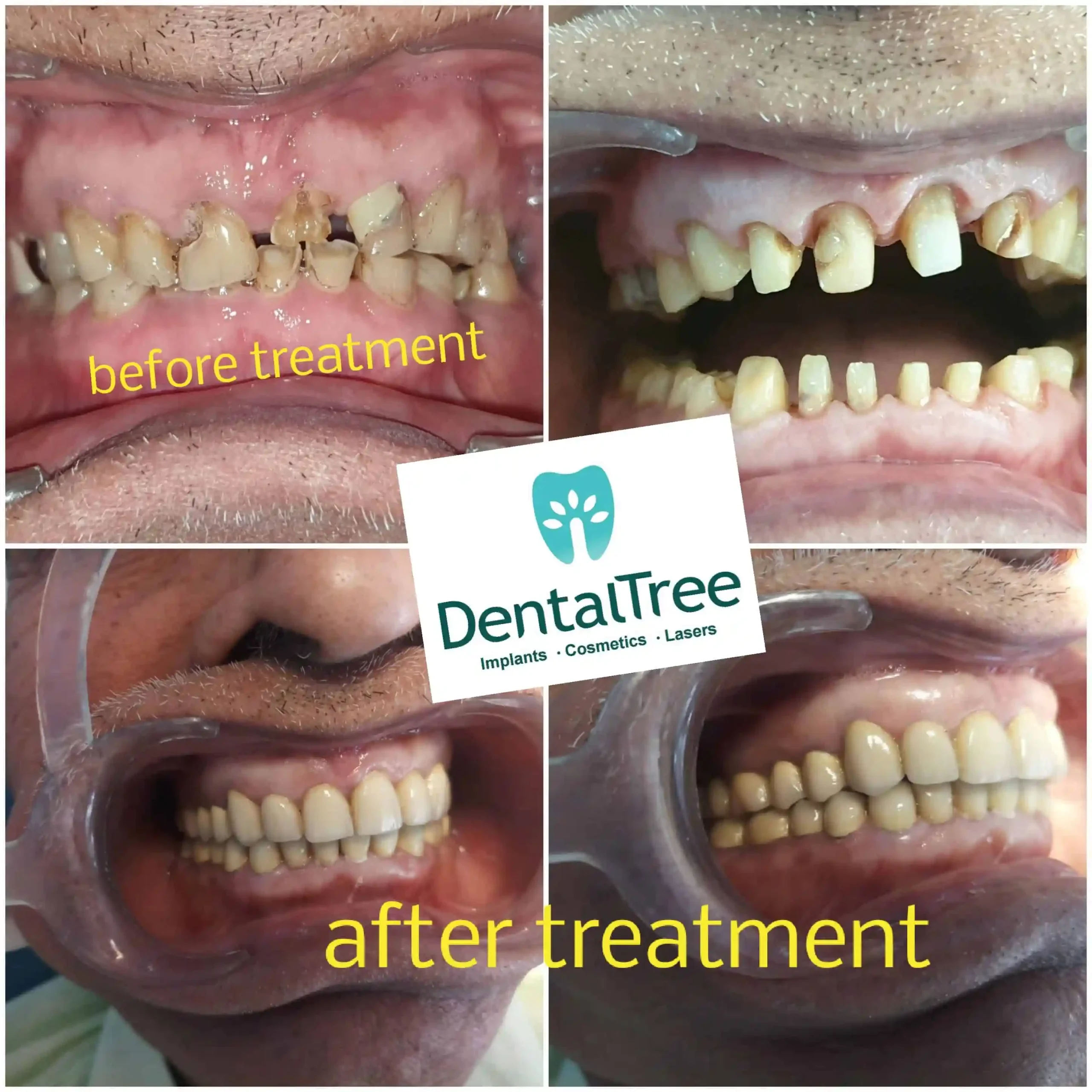 LogoLicious_20200828_124537