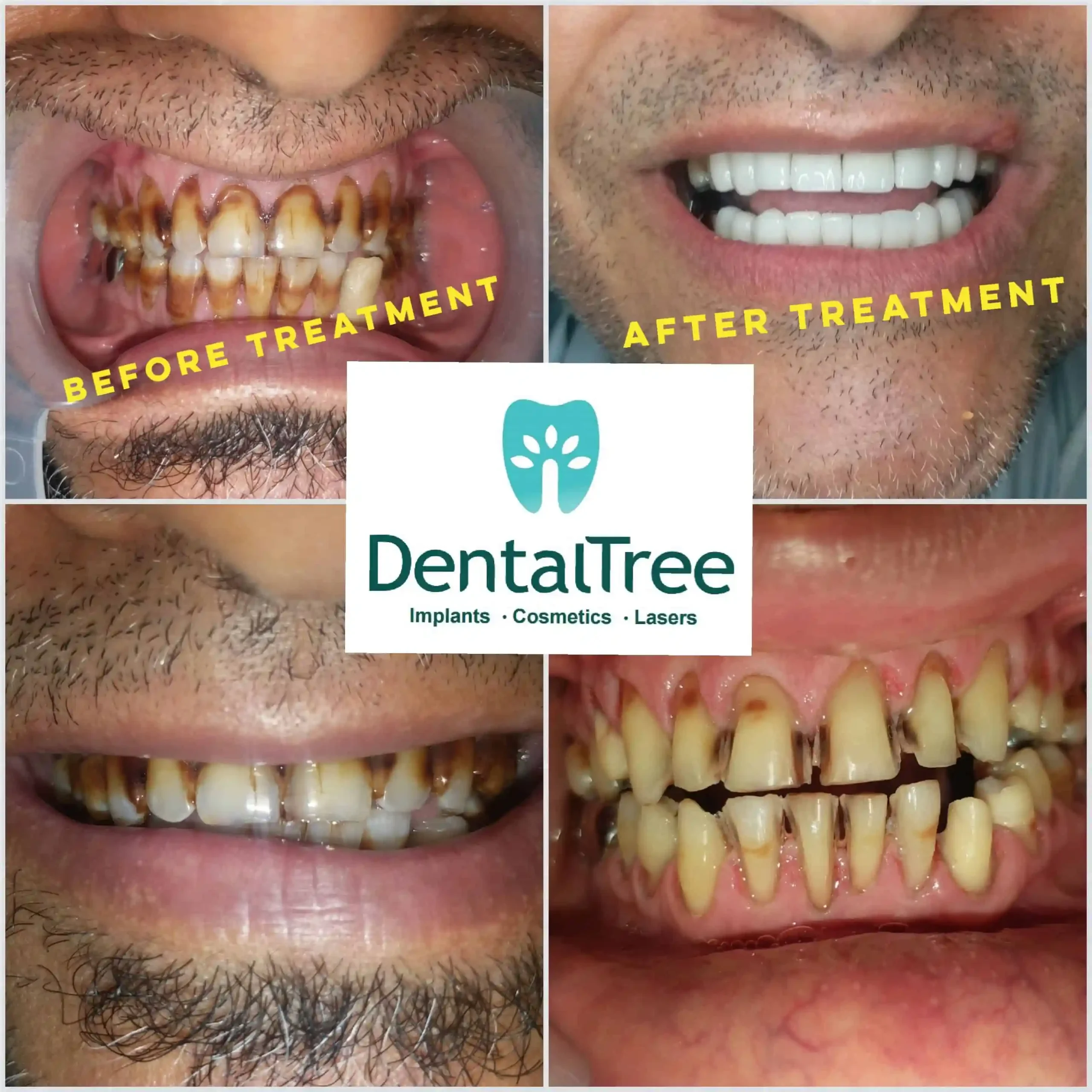 LogoLicious_20200828_130355