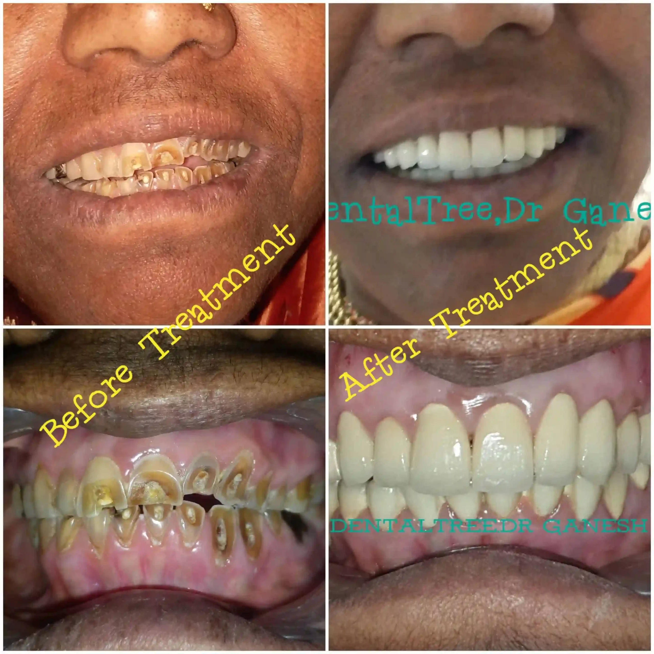 LogoLicious_20200828_130505