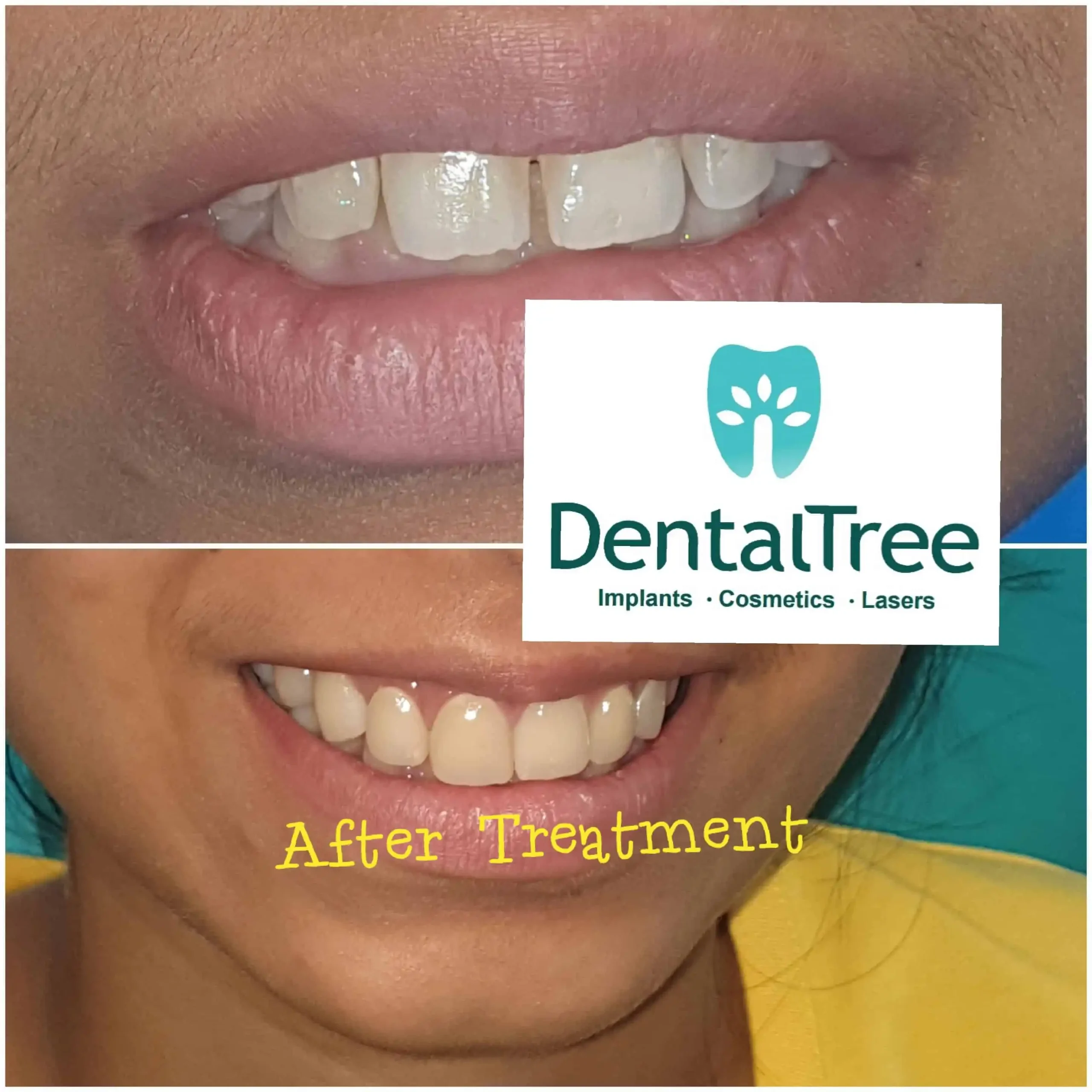 LogoLicious_20200828_130603