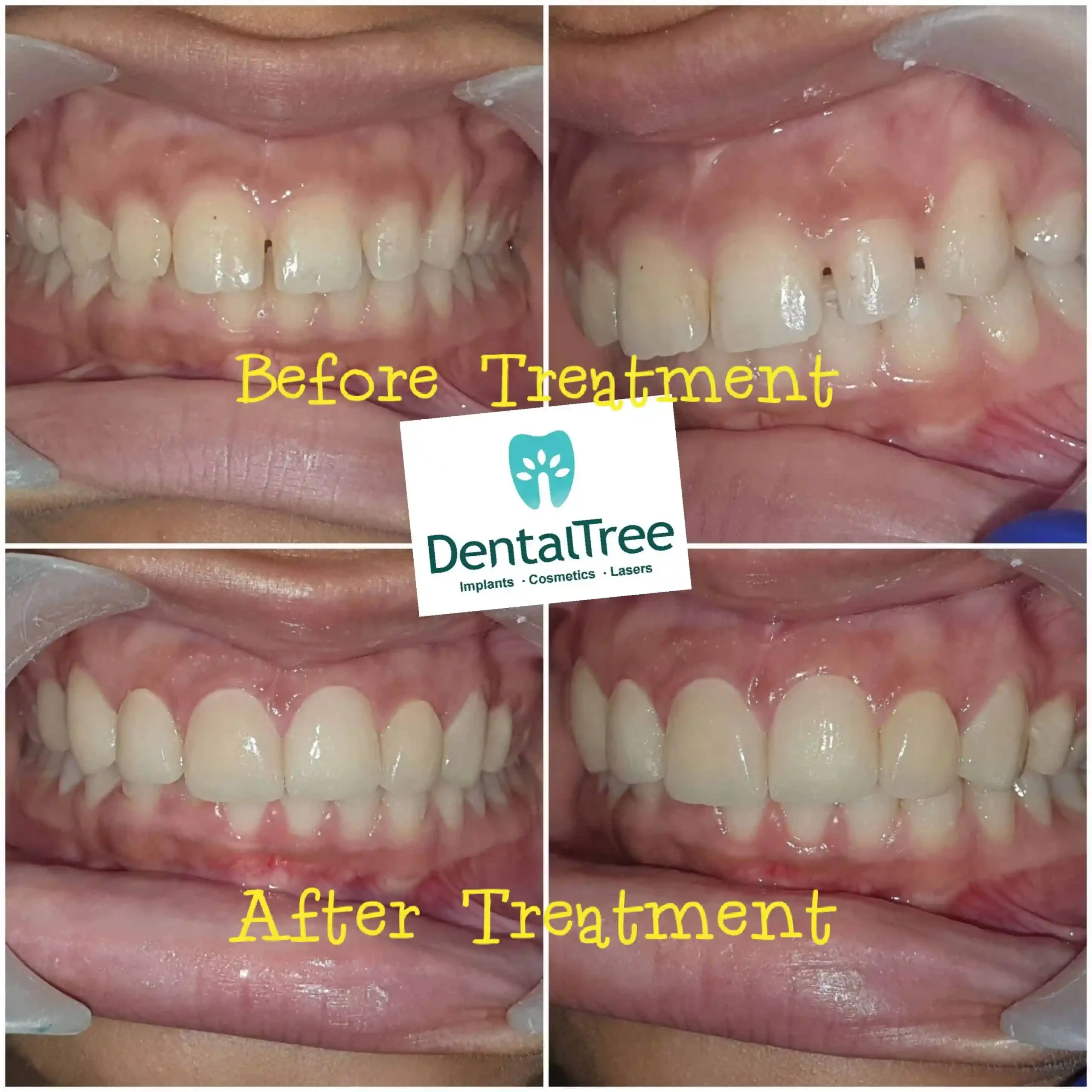 LogoLicious_20200828_130658