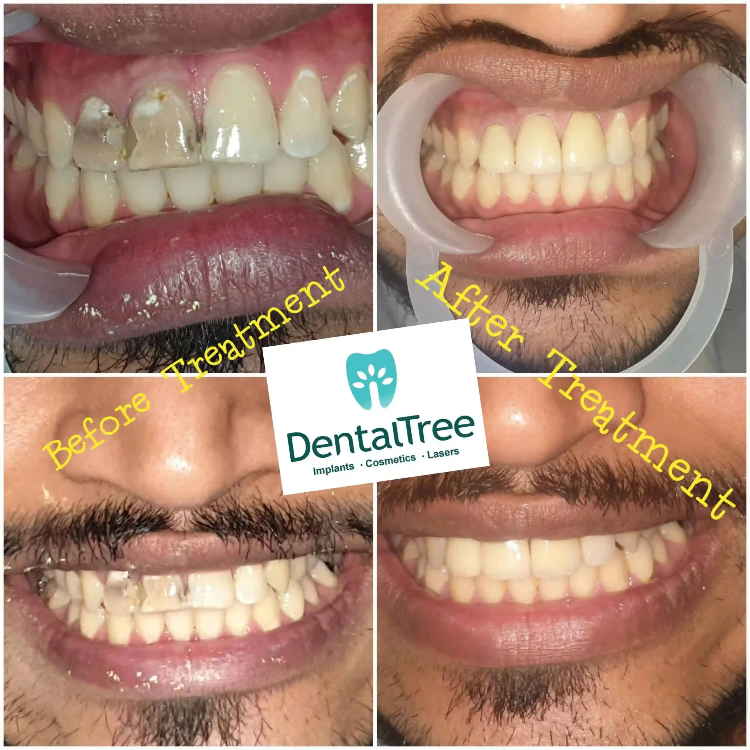 LogoLicious_20200828_130955