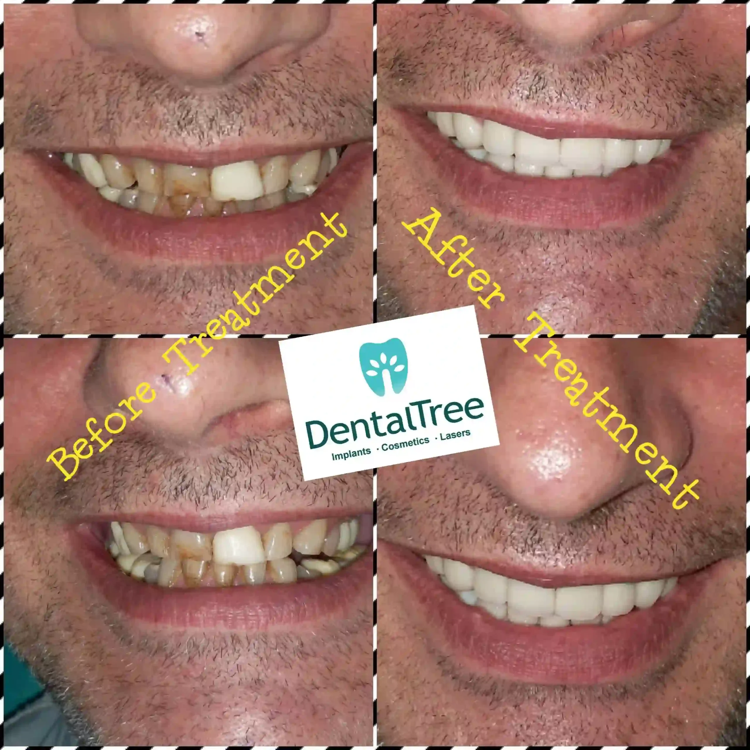 LogoLicious_20200828_131405